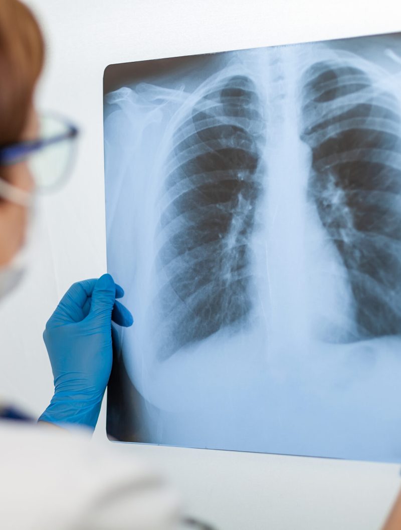 A,Female,Doctor,Examines,An,X-ray,Of,A,Patient,S
